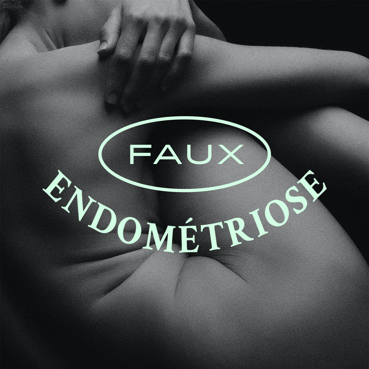 Le VRAI/FAUX de l’endométriose